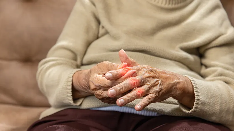 An image of a senior woman suffering from rheumatoid arthritis.